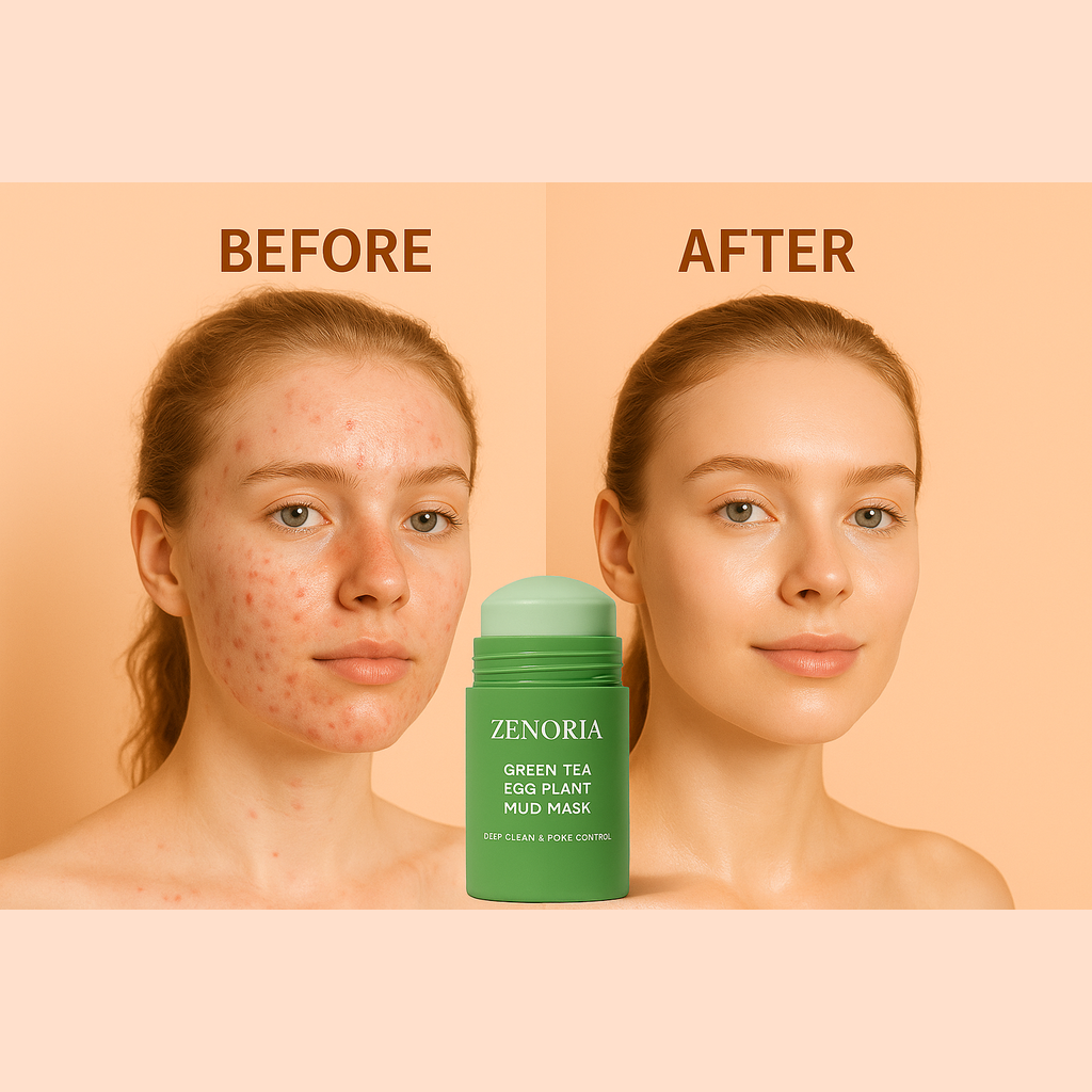 ZENORIA Deep Cleansing Clay Mask for Pores & Acne Control