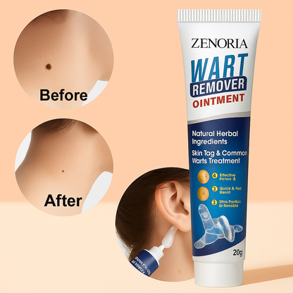 ZENORIA Wart Remover Ointment