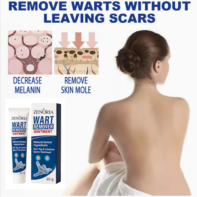 ZENORIA Wart Remover Ointment